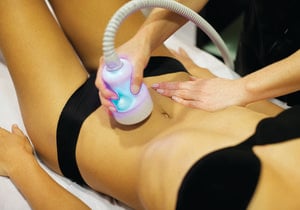 fat reduction with cryo t-shock